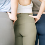 Lipofilling des Hip dips