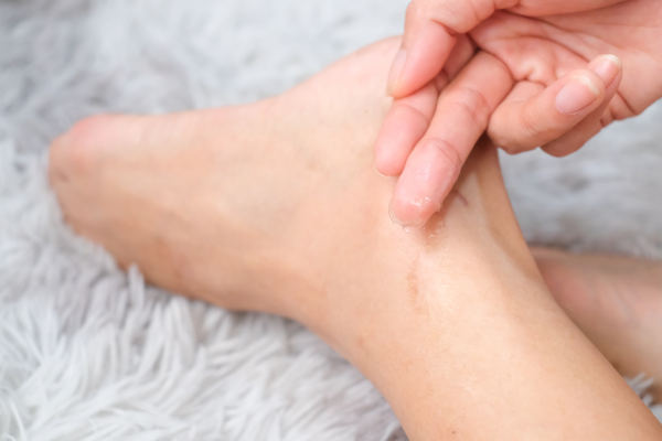 Appliquez du gel peau sèche sur les pieds.