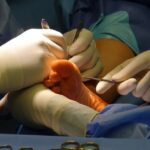 chirurgie orthopédique