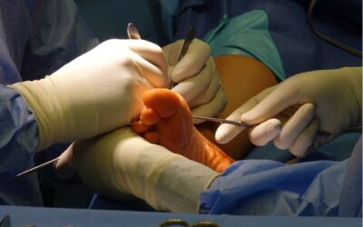 chirurgie orthopédique